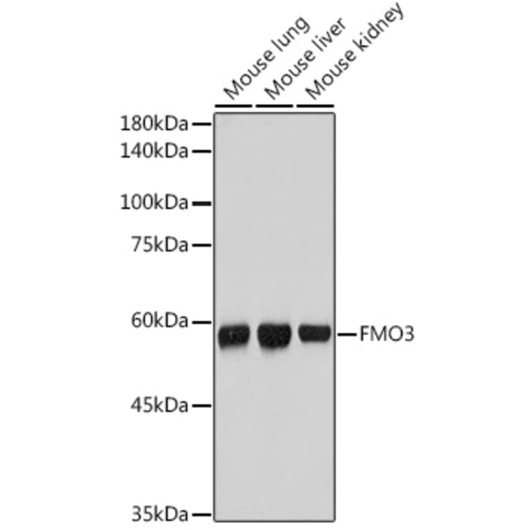 Western Blot - Anti-FMO3 Antibody [ARC2377] (A306452) - Antibodies.com