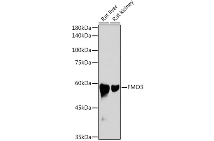 Western Blot - Anti-FMO3 Antibody [ARC2377] (A306452) - Antibodies.com