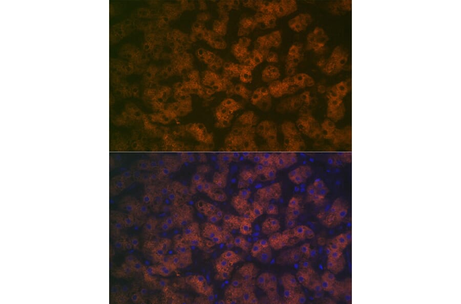 Immunofluorescence - Anti-FMO3 Antibody [ARC2377] (A306452) - Antibodies.com