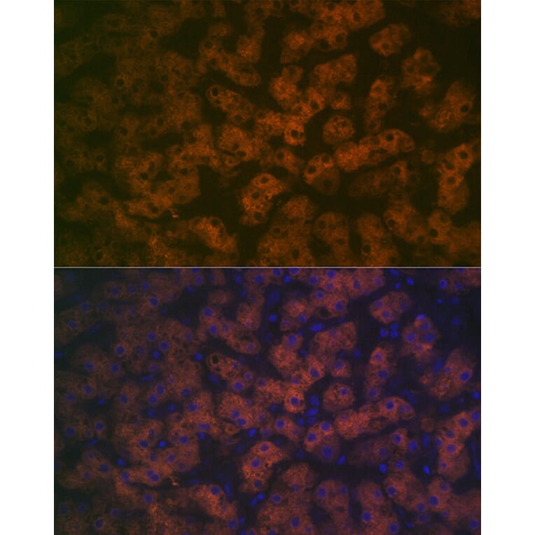 Immunofluorescence - Anti-FMO3 Antibody [ARC2377] (A306452) - Antibodies.com