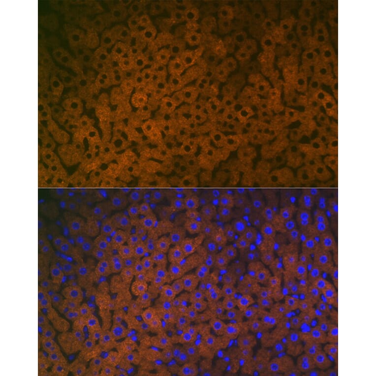 Immunofluorescence - Anti-FMO3 Antibody [ARC2377] (A306452) - Antibodies.com