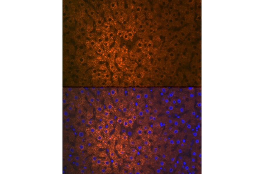 Immunofluorescence - Anti-FMO3 Antibody [ARC2377] (A306452) - Antibodies.com