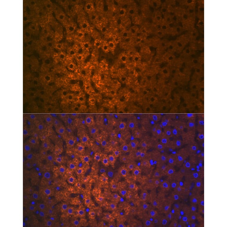 Immunofluorescence - Anti-FMO3 Antibody [ARC2377] (A306452) - Antibodies.com