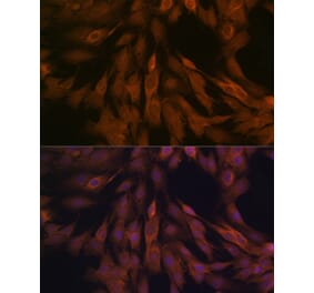 Immunofluorescence - Anti-ULK3 Antibody [ARC2118] (A306455) - Antibodies.com