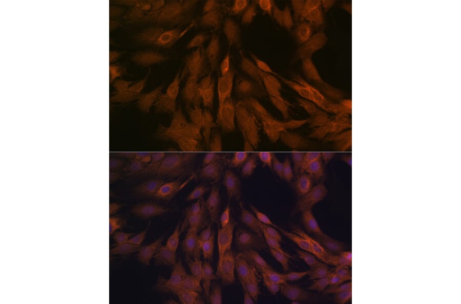 Immunofluorescence - Anti-ULK3 Antibody [ARC2118] (A306455) - Antibodies.com