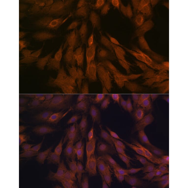 Immunofluorescence - Anti-ULK3 Antibody [ARC2118] (A306455) - Antibodies.com