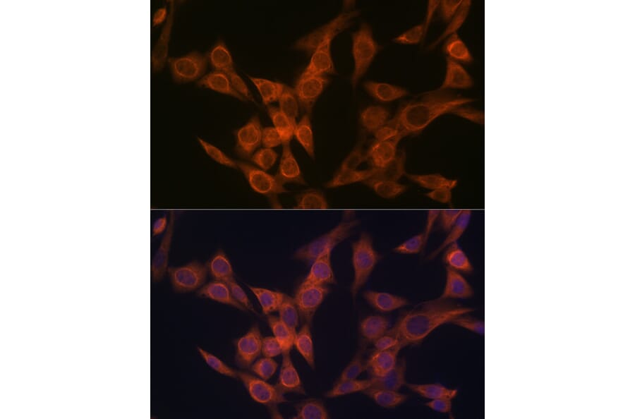 Immunofluorescence - Anti-ULK3 Antibody [ARC2118] (A306455) - Antibodies.com