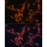Immunofluorescence - Anti-ULK3 Antibody [ARC2118] (A306455) - Antibodies.com