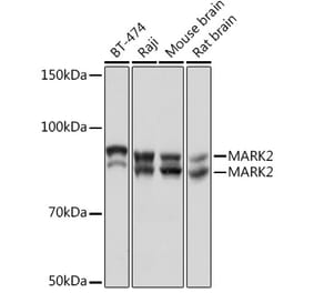 Western Blot - Anti-MARK2 Antibody [ARC1862] (A306456) - Antibodies.com