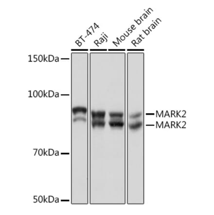 Western Blot - Anti-MARK2 Antibody [ARC1862] (A306456) - Antibodies.com