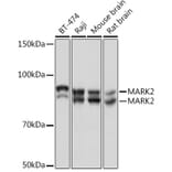 Western Blot - Anti-MARK2 Antibody [ARC1862] (A306456) - Antibodies.com