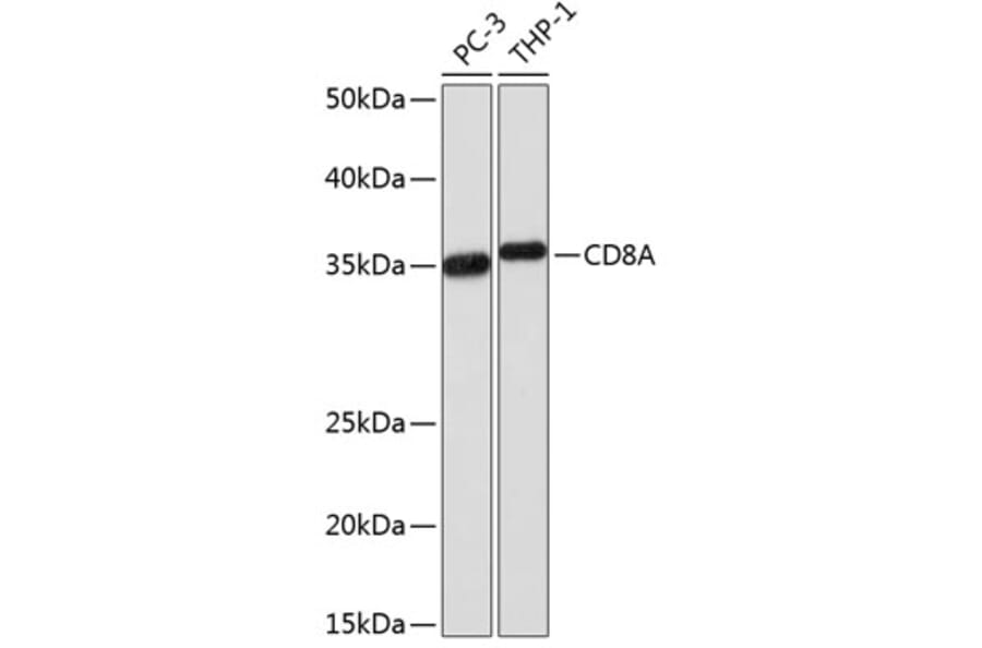 Western Blot - Anti-CD8 alpha Antibody [ARC0329] (A306457) - Antibodies.com
