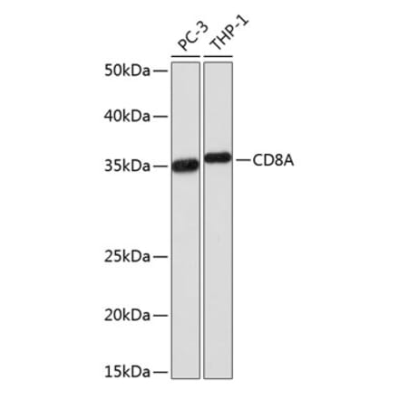 Western Blot - Anti-CD8 alpha Antibody [ARC0329] (A306457) - Antibodies.com