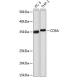 Western Blot - Anti-CD8 alpha Antibody [ARC0329] (A306457) - Antibodies.com