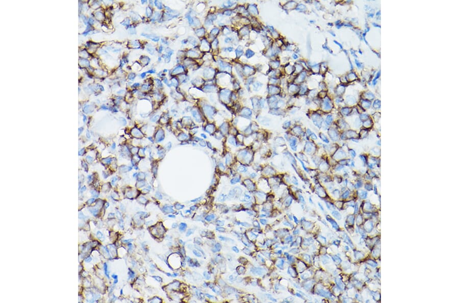 Immunohistochemistry - Anti-CD8 alpha Antibody [ARC0329] (A306457) - Antibodies.com