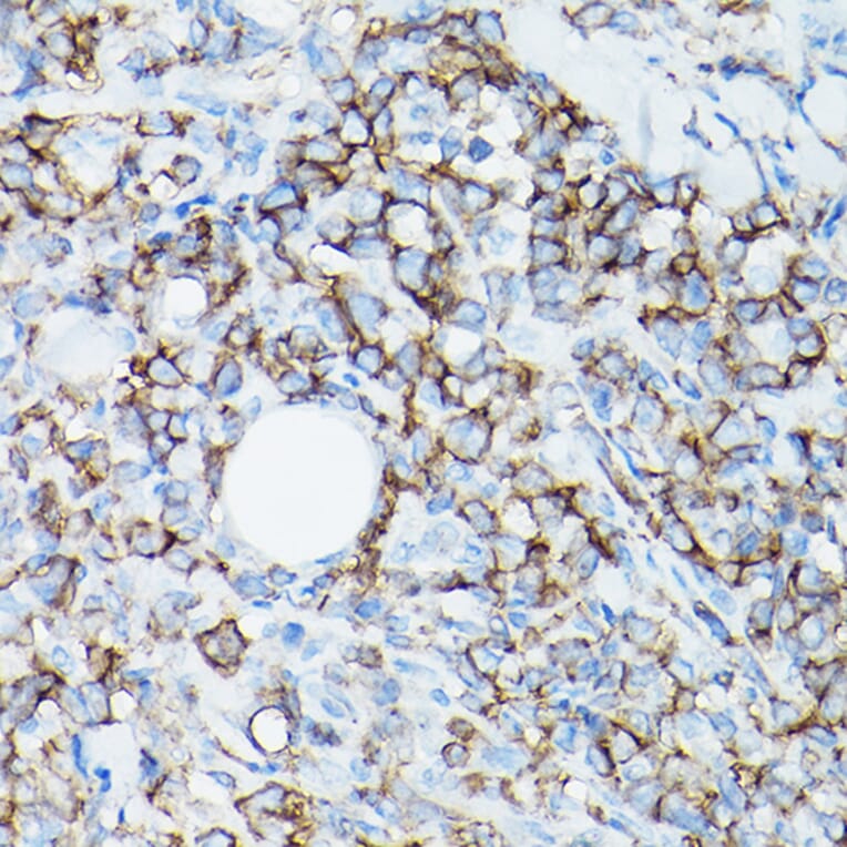 Immunohistochemistry - Anti-CD8 alpha Antibody [ARC0329] (A306457) - Antibodies.com
