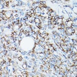 Immunohistochemistry - Anti-CD8 alpha Antibody [ARC0329] (A306457) - Antibodies.com