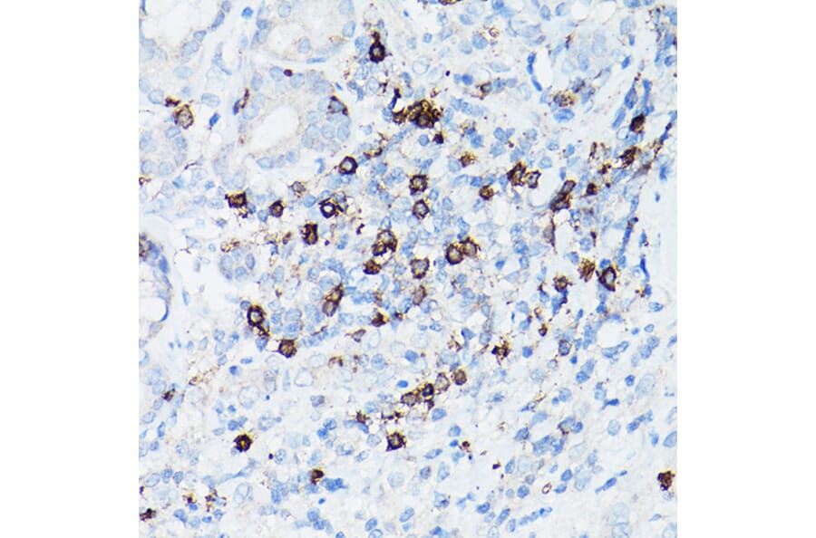 Immunohistochemistry - Anti-CD8 alpha Antibody [ARC0329] (A306457) - Antibodies.com