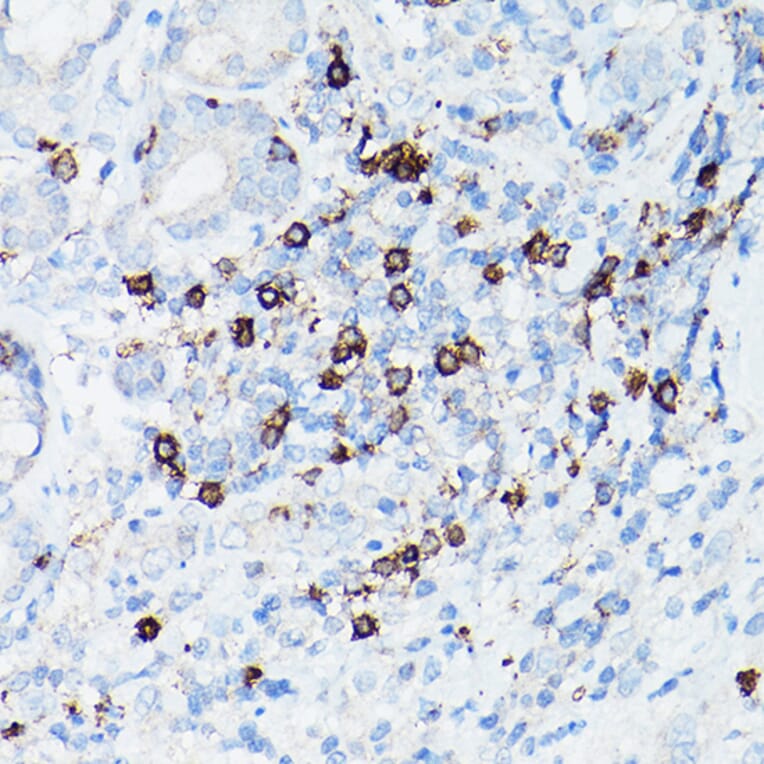 Immunohistochemistry - Anti-CD8 alpha Antibody [ARC0329] (A306457) - Antibodies.com