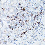 Immunohistochemistry - Anti-CD8 alpha Antibody [ARC0329] (A306457) - Antibodies.com