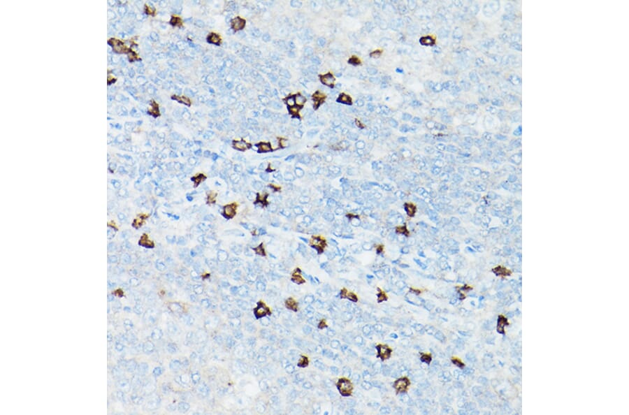Immunohistochemistry - Anti-CD8 alpha Antibody [ARC0329] (A306457) - Antibodies.com
