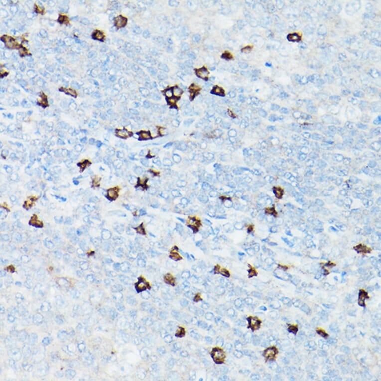 Immunohistochemistry - Anti-CD8 alpha Antibody [ARC0329] (A306457) - Antibodies.com