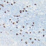 Immunohistochemistry - Anti-CD8 alpha Antibody [ARC0329] (A306457) - Antibodies.com