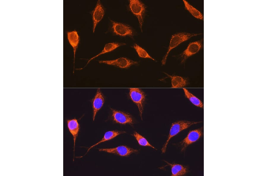 Immunofluorescence - Anti-RCN1/RCN Antibody (A306458) - Antibodies.com