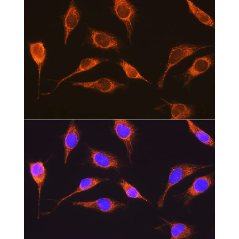 Immunofluorescence - Anti-RCN1/RCN Antibody (A306458) - Antibodies.com