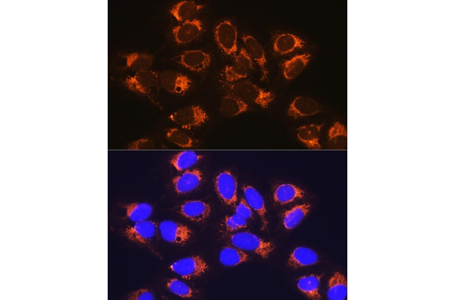 Immunofluorescence - Anti-RCN1/RCN Antibody (A306458) - Antibodies.com