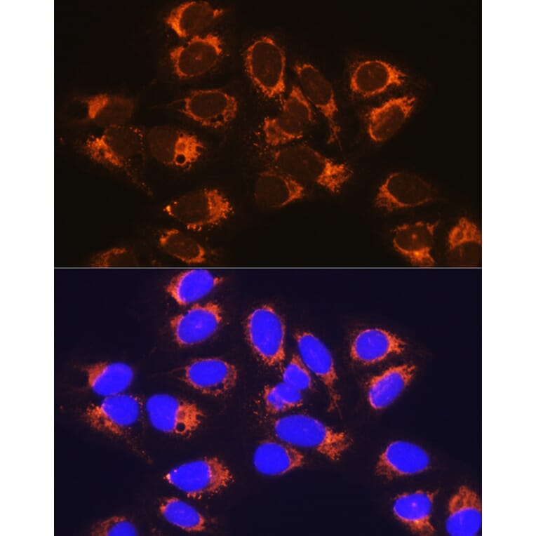 Immunofluorescence - Anti-RCN1/RCN Antibody (A306458) - Antibodies.com