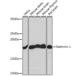 Western Blot - Anti-Stathmin 1 Antibody [ARC0989] (A306459) - Antibodies.com