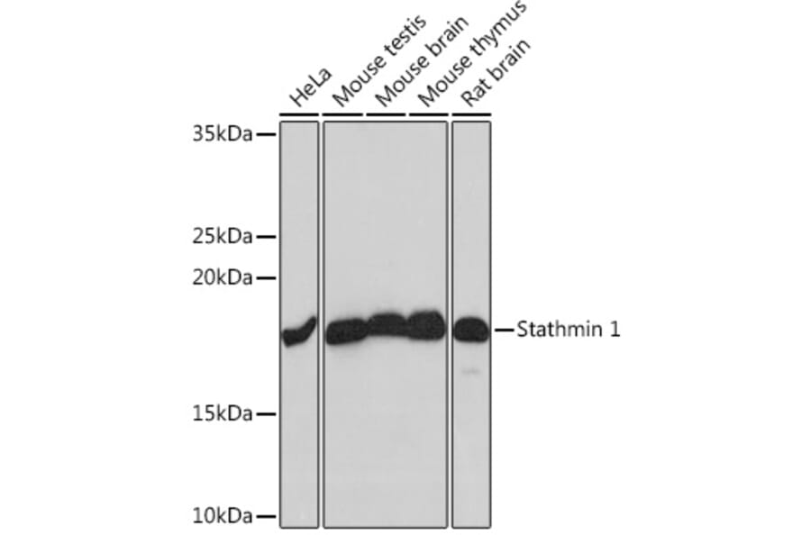 Western Blot - Anti-Stathmin 1 Antibody [ARC0989] (A306459) - Antibodies.com