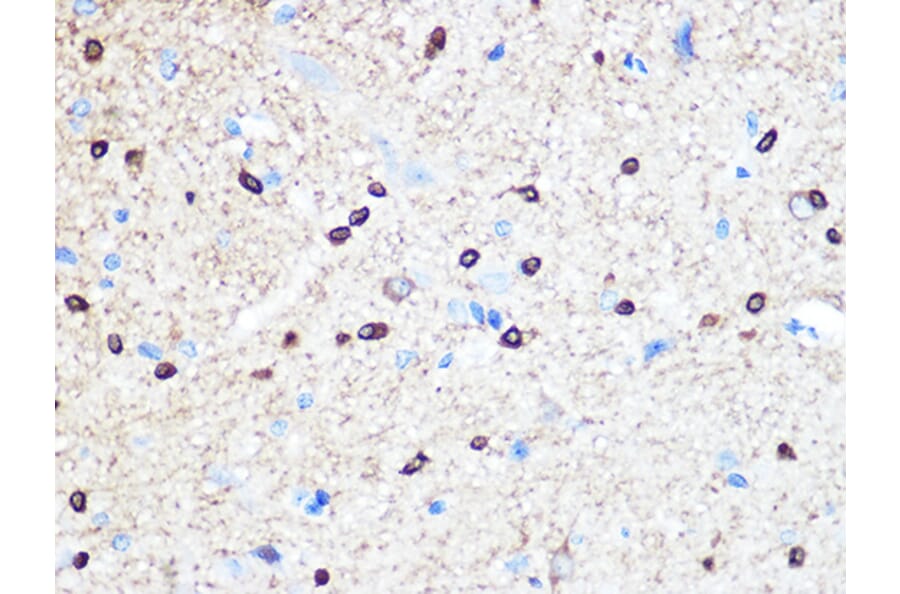 Immunohistochemistry - Anti-Stathmin 1 Antibody [ARC0989] (A306459) - Antibodies.com
