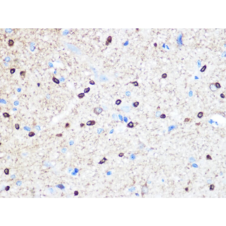 Immunohistochemistry - Anti-Stathmin 1 Antibody [ARC0989] (A306459) - Antibodies.com