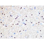 Immunohistochemistry - Anti-Stathmin 1 Antibody [ARC0989] (A306459) - Antibodies.com