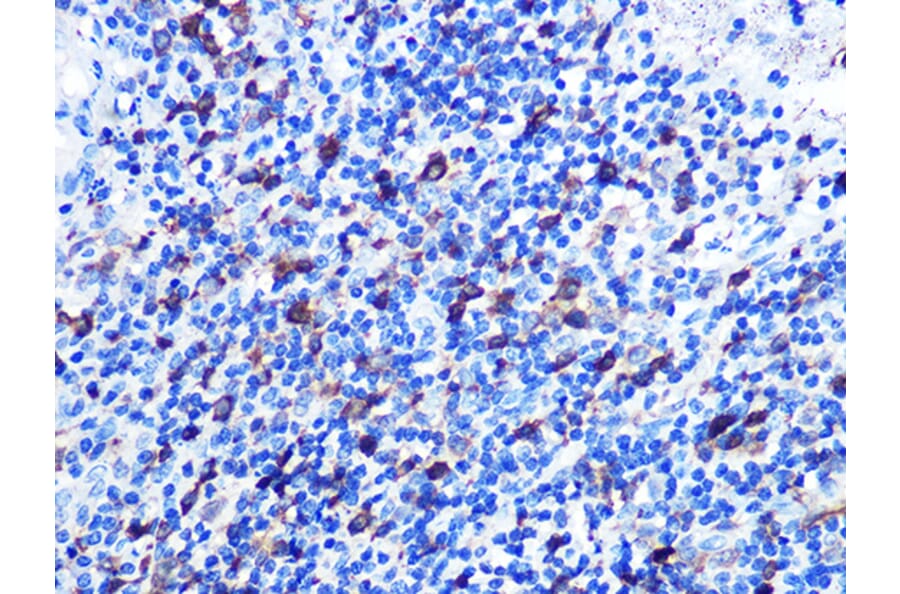 Immunohistochemistry - Anti-Stathmin 1 Antibody [ARC0989] (A306459) - Antibodies.com