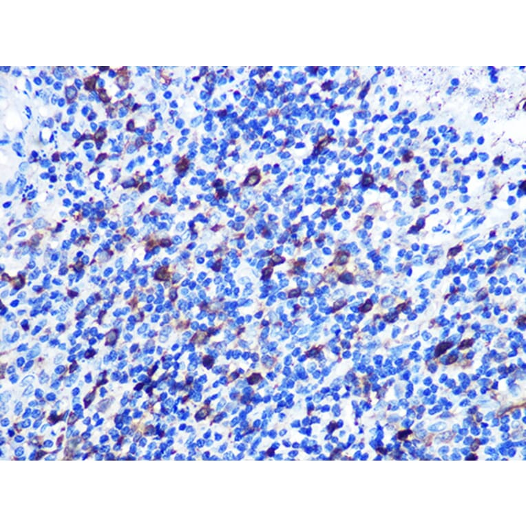 Immunohistochemistry - Anti-Stathmin 1 Antibody [ARC0989] (A306459) - Antibodies.com