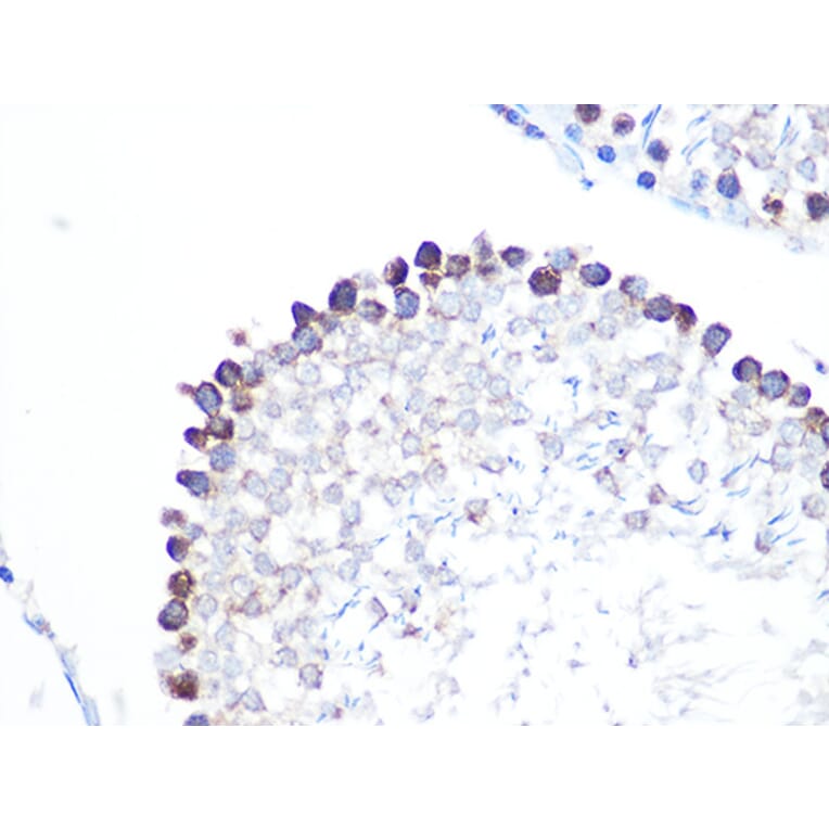 Immunohistochemistry - Anti-Stathmin 1 Antibody [ARC0989] (A306459) - Antibodies.com