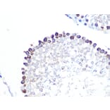 Immunohistochemistry - Anti-Stathmin 1 Antibody [ARC0989] (A306459) - Antibodies.com