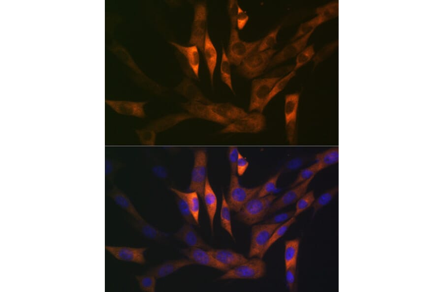 Immunofluorescence - Anti-Stathmin 1 Antibody [ARC0989] (A306459) - Antibodies.com