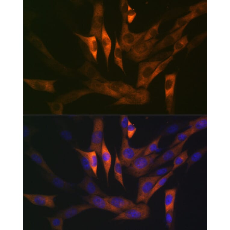 Immunofluorescence - Anti-Stathmin 1 Antibody [ARC0989] (A306459) - Antibodies.com