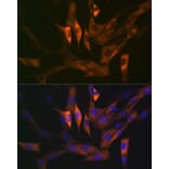 Immunofluorescence - Anti-Stathmin 1 Antibody [ARC0989] (A306459) - Antibodies.com