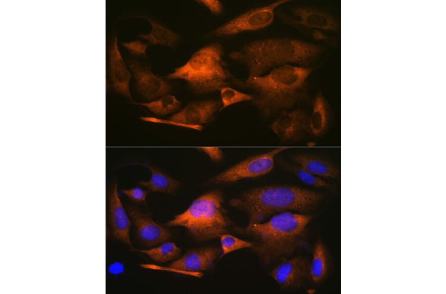 Immunofluorescence - Anti-Stathmin 1 Antibody [ARC0989] (A306459) - Antibodies.com