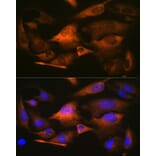 Immunofluorescence - Anti-Stathmin 1 Antibody [ARC0989] (A306459) - Antibodies.com