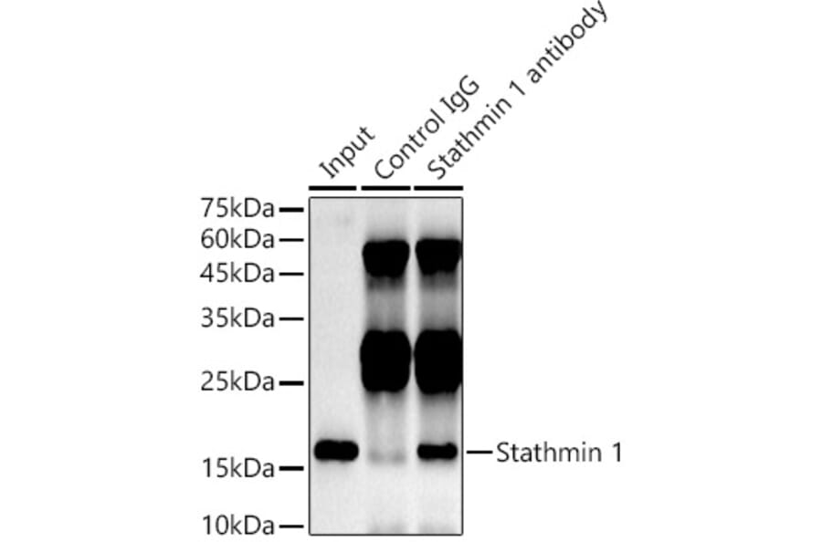 Western Blot - Anti-Stathmin 1 Antibody [ARC0989] (A306459) - Antibodies.com