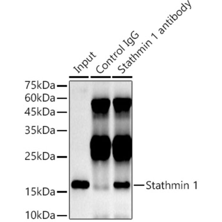 Western Blot - Anti-Stathmin 1 Antibody [ARC0989] (A306459) - Antibodies.com