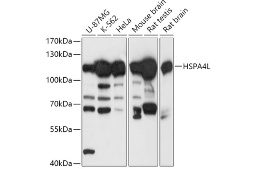 Western Blot - Anti-HSPA4L Antibody (A306461) - Antibodies.com