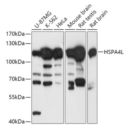 Western Blot - Anti-HSPA4L Antibody (A306461) - Antibodies.com