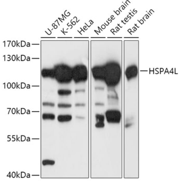 Western Blot - Anti-HSPA4L Antibody (A306461) - Antibodies.com